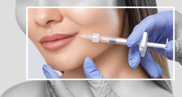 liquid rhinoplasty in Abu Dhabi