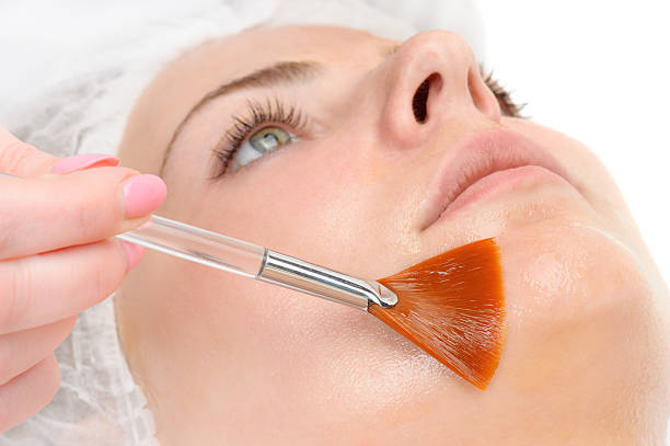 chemical peels in Abu Dhabi