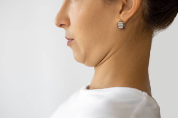 Double Chin Liposuction in Abu Dhabi