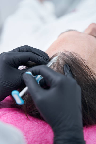 Platelet rich plasma hair treatment in Abu Dhabi