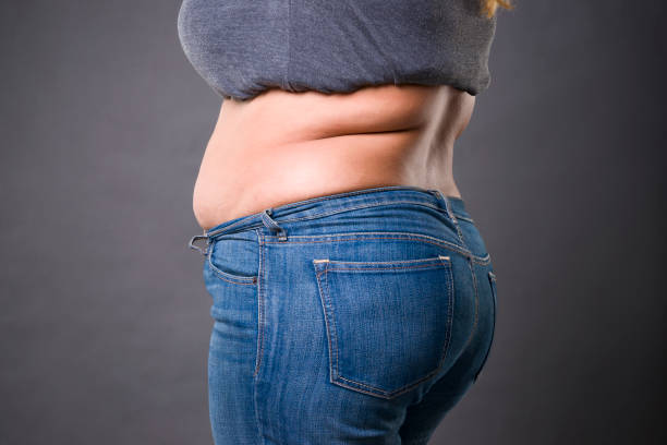 Mini Abdominoplasty in abu dhabi