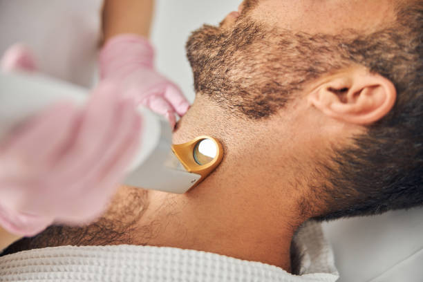 Beard Laser Hair Removal in Abu Dhabi