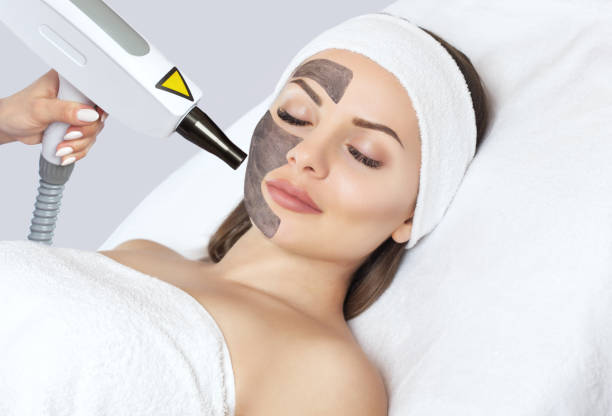 Carbon Laser Facial Price in Abu Dhabi