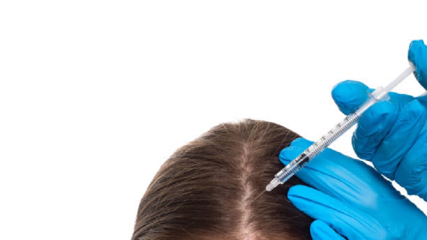 Scalp Micropigmentation in Abu Dhabi