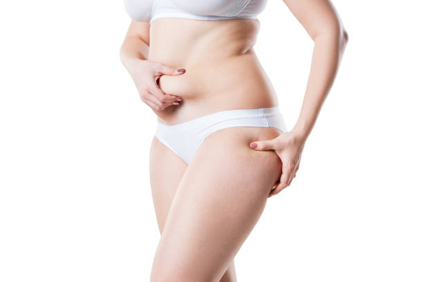 liposuction in Abu Dhabi