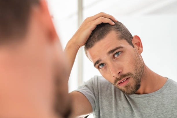 Hair Loss Treatments in Abu Dhabi