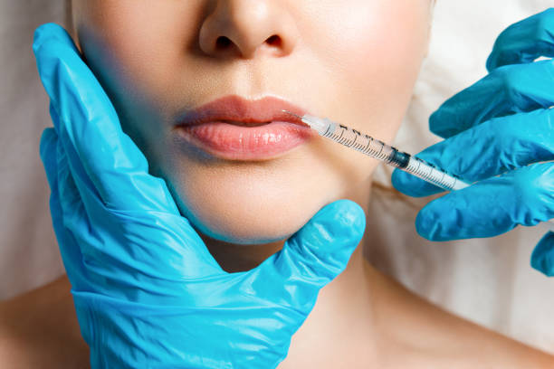 Russian lip fillers in Abu Dhabi