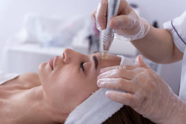 Dermapen Microneedling in Abu Dhabi