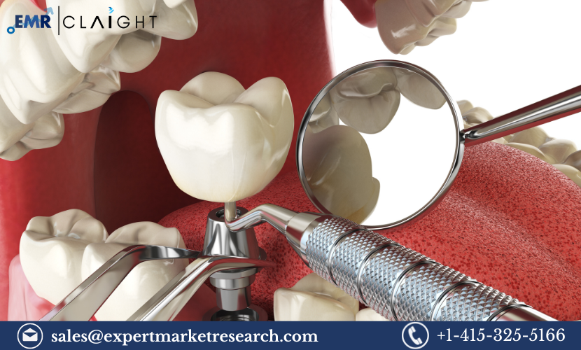 Smart Implants Market